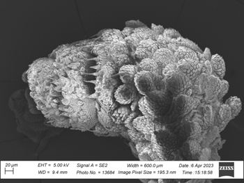 Media type: image;   Invertebrate Zoology 32029 Description: SEM image of specimen.;